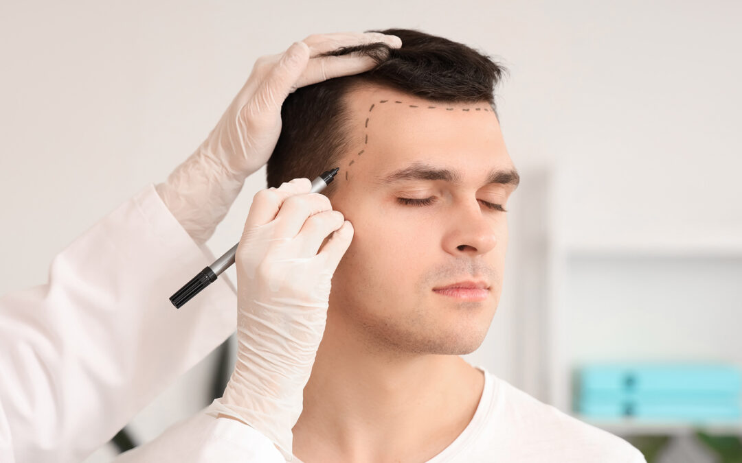 Restauración Capilar: Guía Maternal para Decisiones Estéticas Familiares