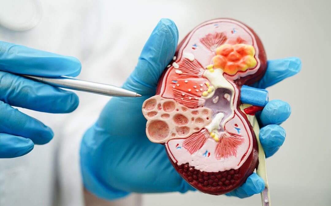 Kidney Disease Clinical Trials: Advancing Treatments and Offering Hope