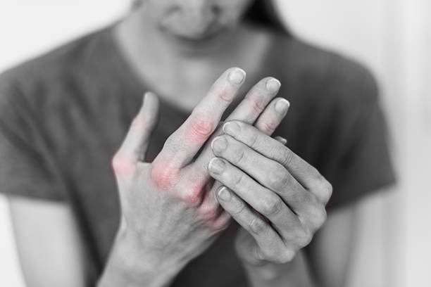 Arthritis Stem Cell Therapy Clinical Trials: A New Horizon in Joint Treatment